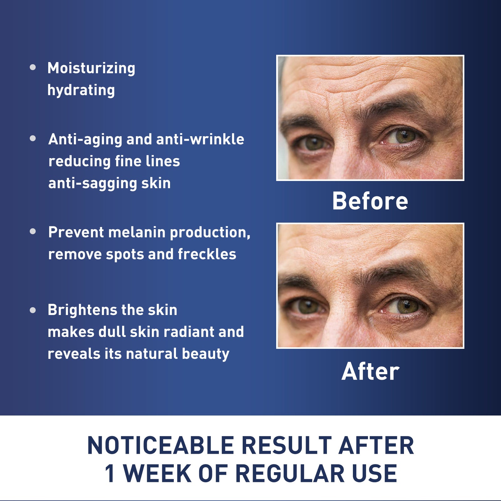 East Moon Men's Anti-Aging Face Cream - Brightening & Wrinkle-Reducing Moisturizer with Niacinamide & Glycerin