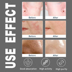 East Moon Tea Tree Oil-Control Cleanser (100g)