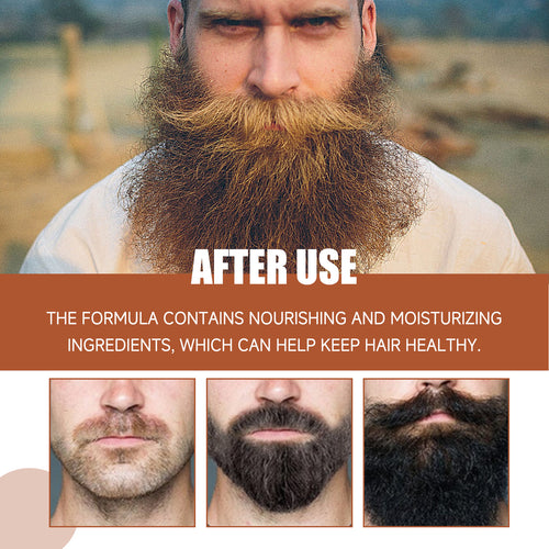 East Moon Beard Care Serum – Nourishing & Softening Treatment