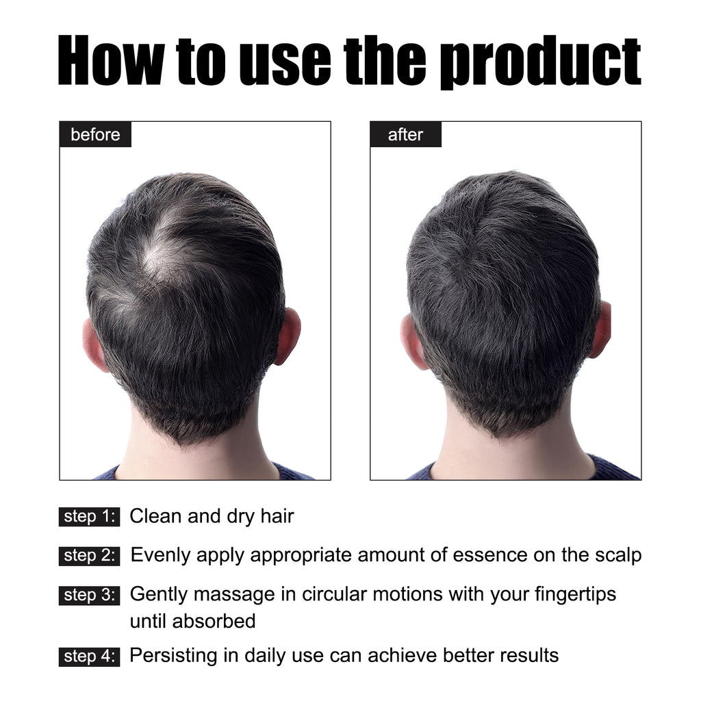 East Moon Men's Hair Growth Serum - Thicker & Fuller Hair Density Activator with Rosemary Oil & Glycerin