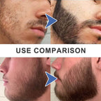 East Moon 3-in-1 Beard Filler Pen Kit – Waterproof Beard Definer