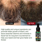 EELHOE Fast-Absorbing Beard Conditioner Spray