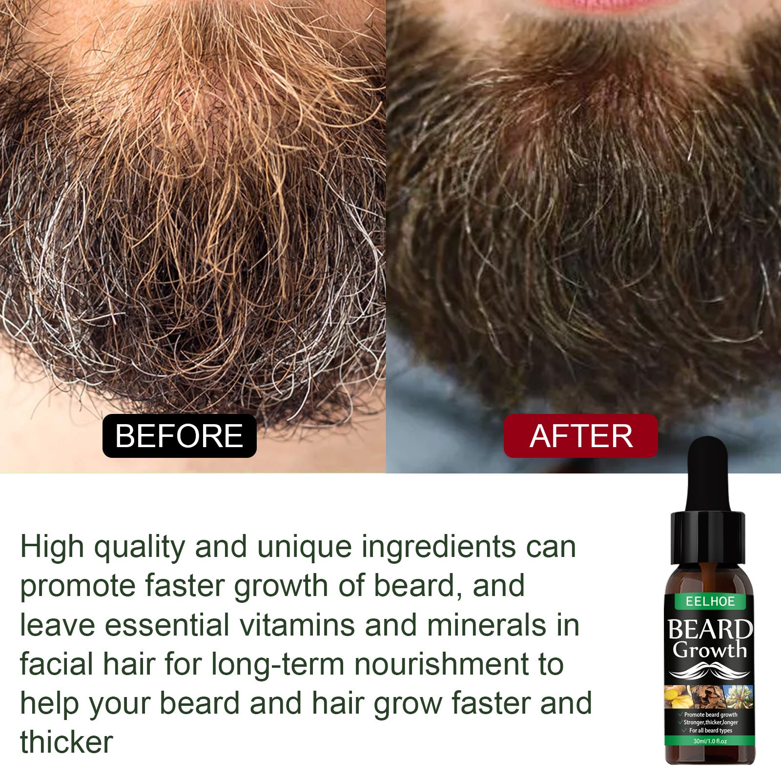 EELHOE Beard Growth Oil Spray - Fast Absorbing Conditioner for Thicker, Fuller & Softer Facial Hair
